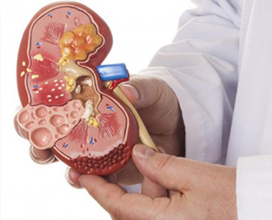 Başarılı Tedavi 3